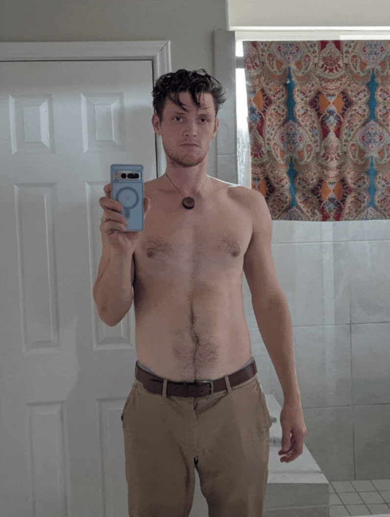 Steven after one week — alternate front view