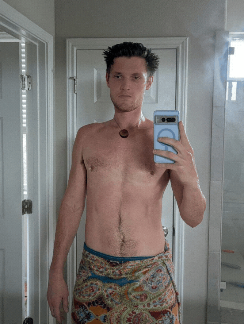 Steven after one week — front view